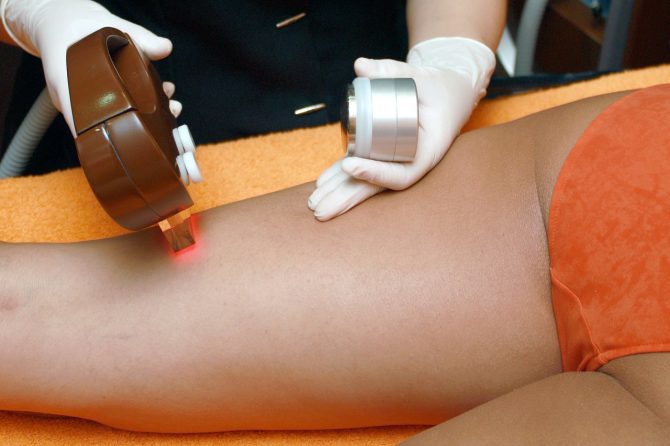 How Much Does Laser Hair Removal Cost?
