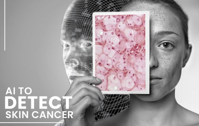 Artificial Intelligence Showed Potential in Helping Detect Skin Cancer ...