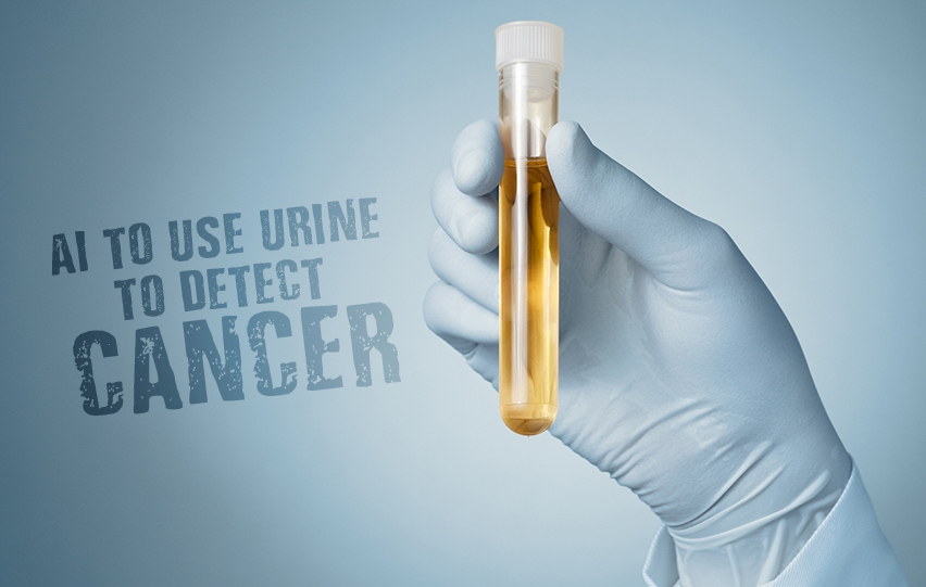 Urine to Detect Prostate Cancer