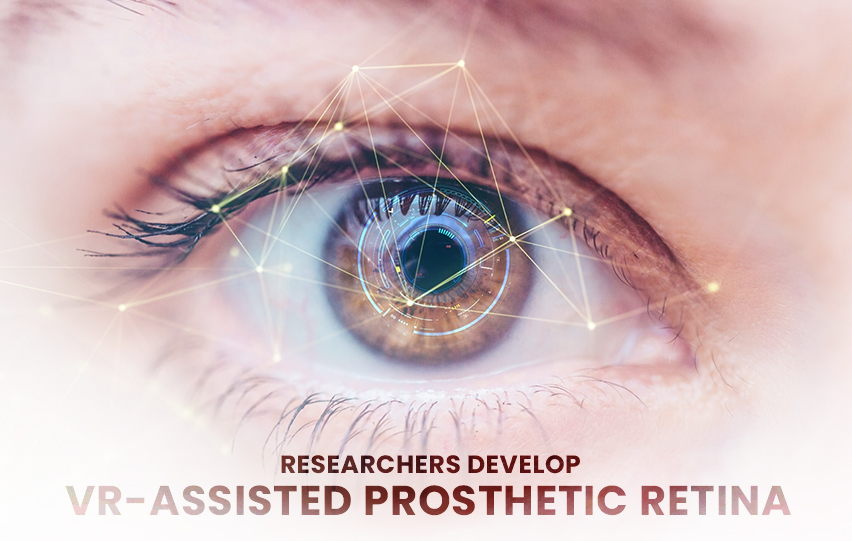 VR-Assisted Prosthetic Retina
